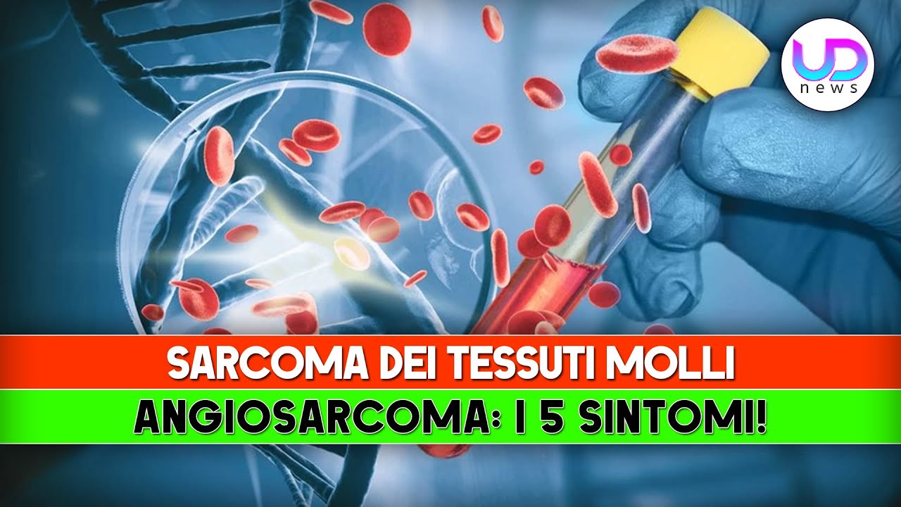 Sarcoma Dei Tessuti Molli, Angiosarcoma: I 5 Sintomi per Riconoscerlo!