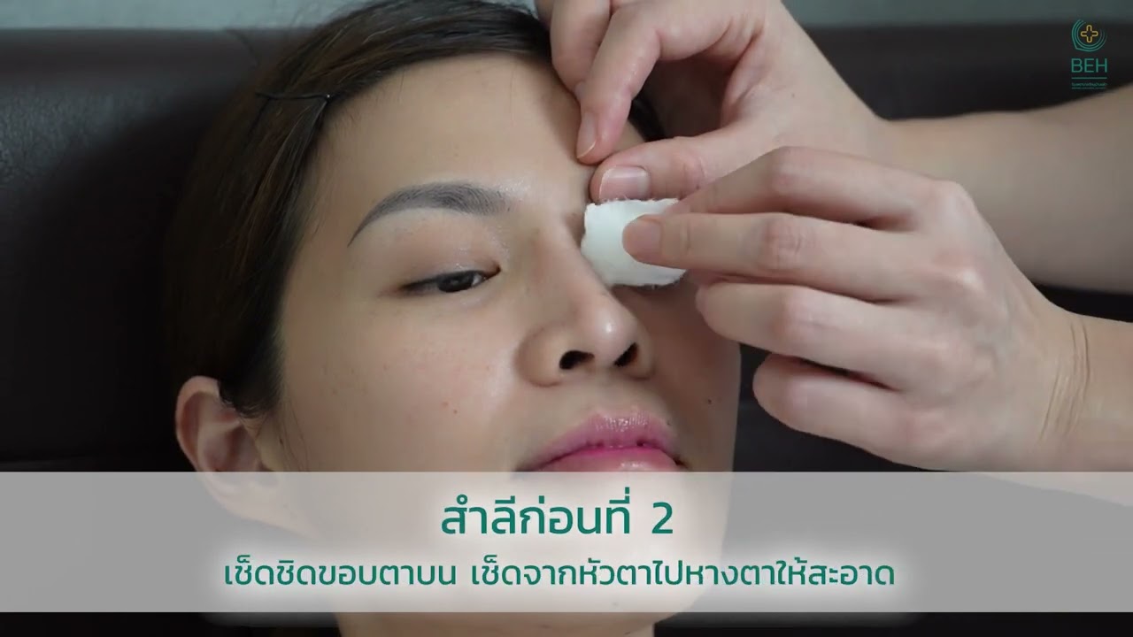 ขั้นตอนการเช็ดตาด้วยเทคนิคปลอดเชื้อ