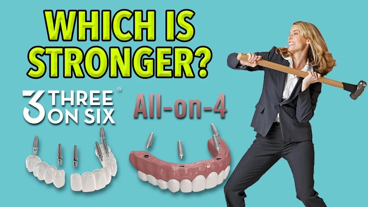 Which is Stronger: All-on-4 vs 3 on 6™
