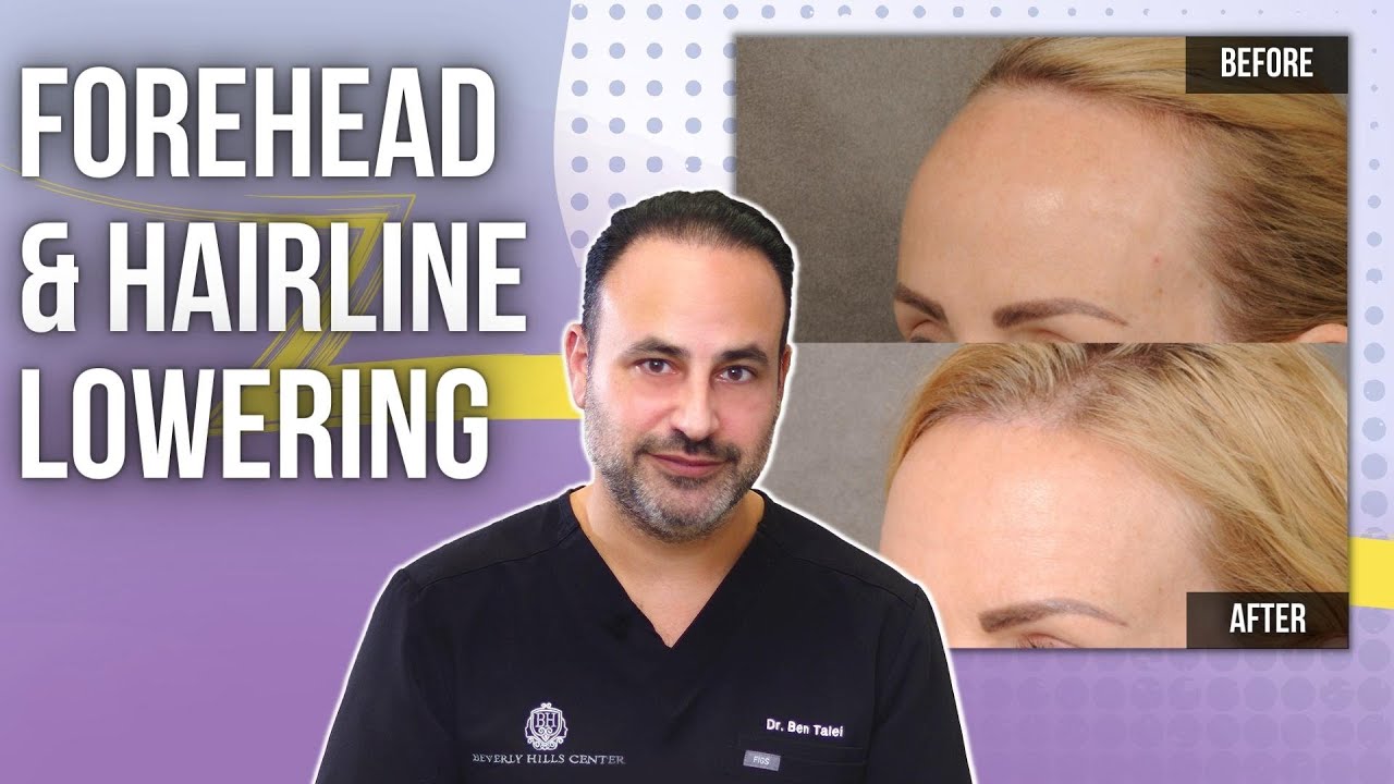 Forehead Lowering   Lesson of the Day
