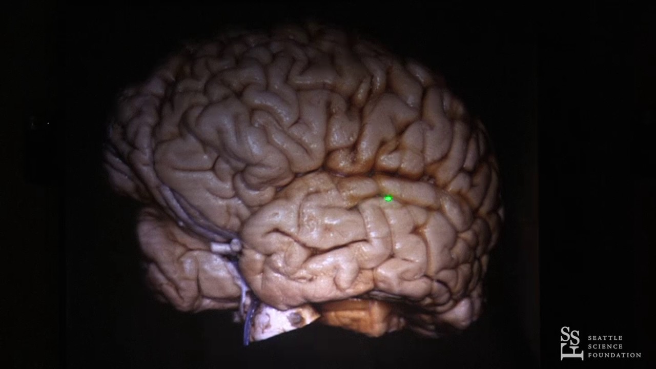The Brain Surface Sulci & Gyri by Guilherme Carvalhal Ribas, M.D.