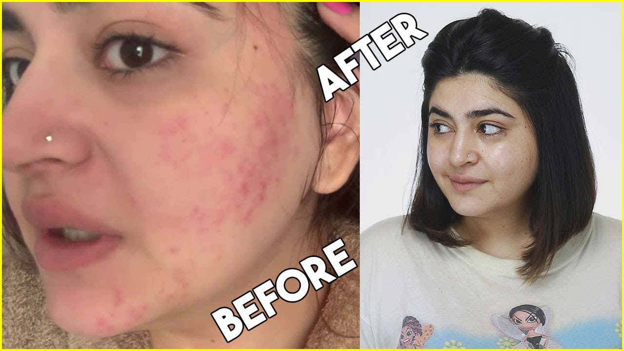 BASIC EVERYDAY SKIN CARE YOUR SKIN NEEDS | STEP BY STEP | GLOSSIPS