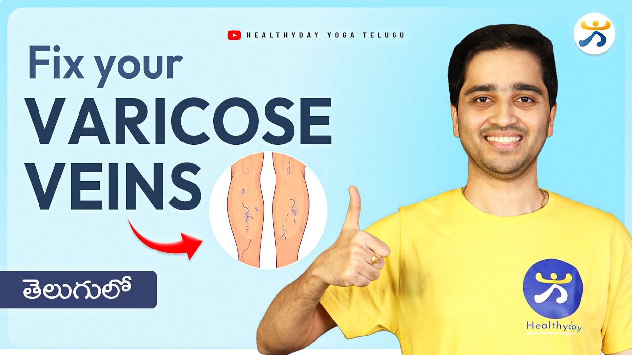 5 Simple Exercises for Varicose Veins | వారికోస్ వెయిన్స్ తగ్గాలంటే ఈ 5 ఆసనాలు చేయండి