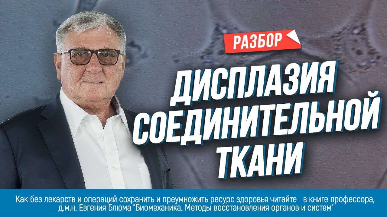 Дисплазия соединительной ткани. Разбор профессора, д.м.н. Евгения Блюма