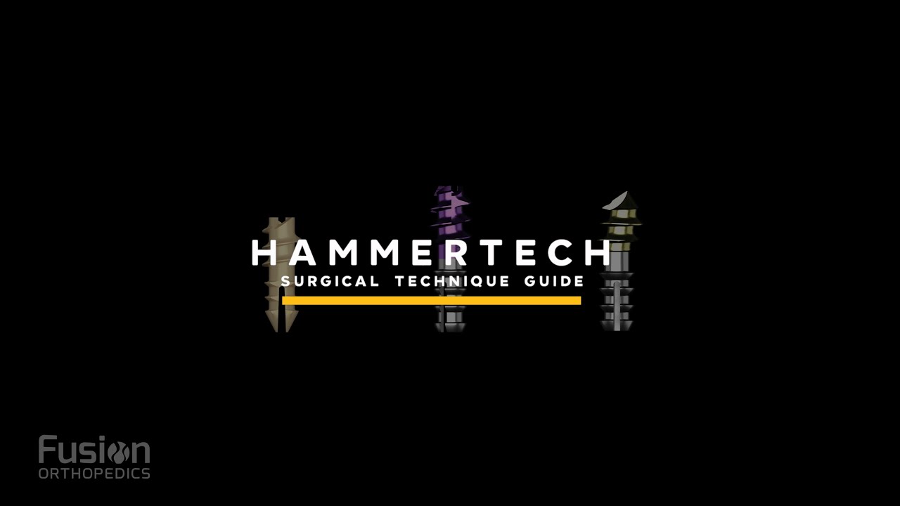 HammerTech Peek & Titanium Surgical Technique