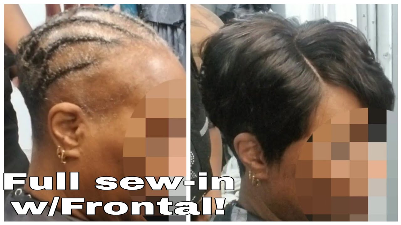 #037 (PART 1)FRONTAL SEW-IN ALOPECIA NO EDGES