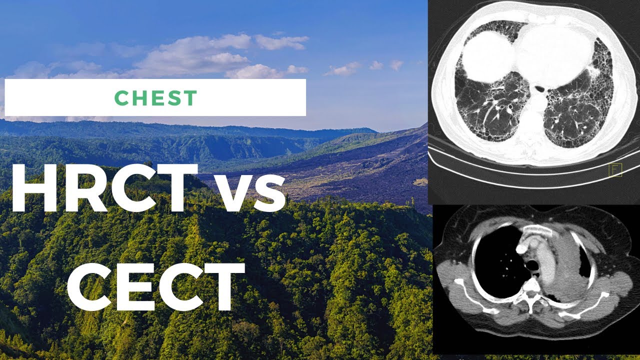 HRCT vs CECT