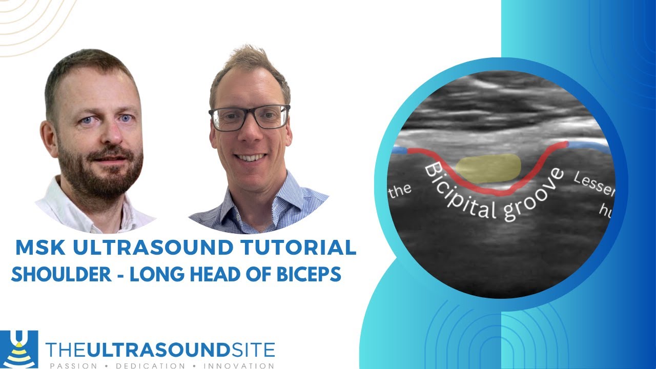 Shoulder ultrasound: How to scan the long head of biceps tendon