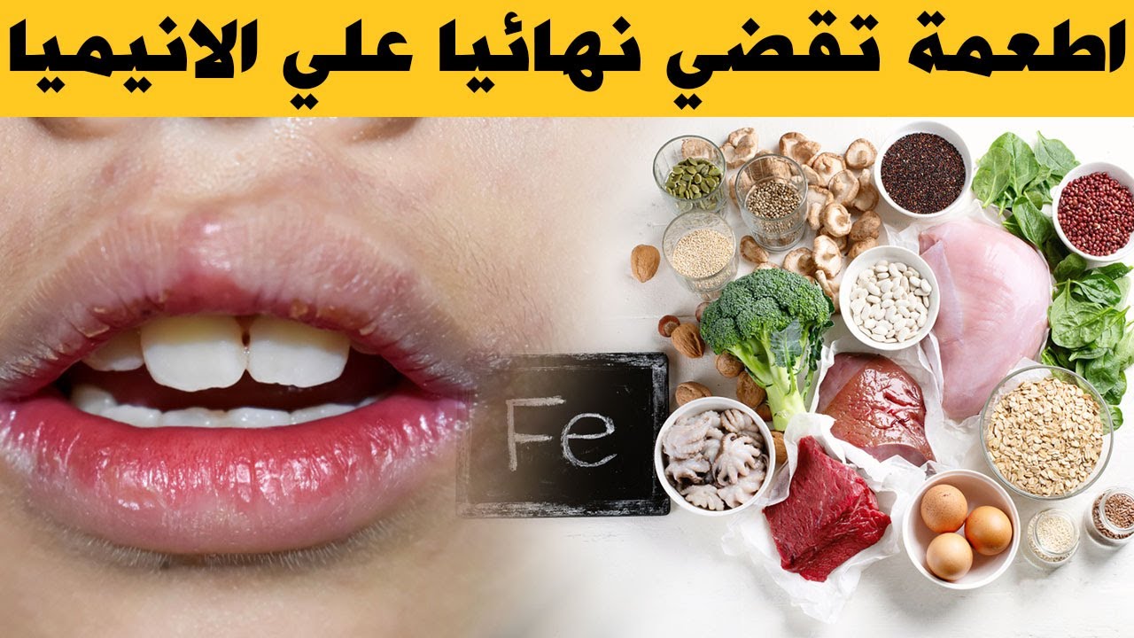 أطعمة مهمة لعلاج فقر الدم عند الاطفال (الانيميا) في اسرع وقت | أطعمة غنية بالحديد للاطفال