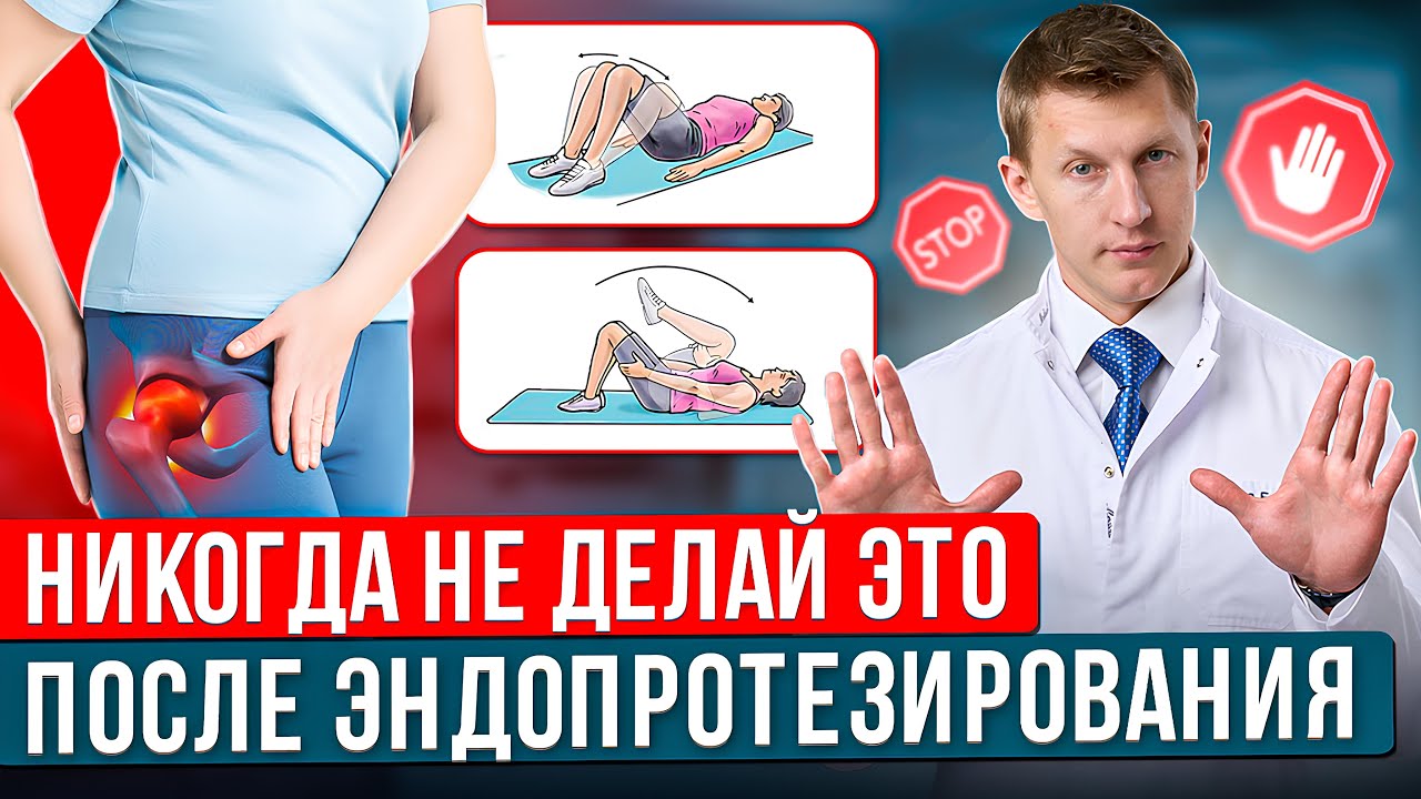 ЭТИ УПРАЖНЕНИЯ СЛЕДУЕТ ИЗБЕГАТЬ после эндопротезирования тазобедренного сустава