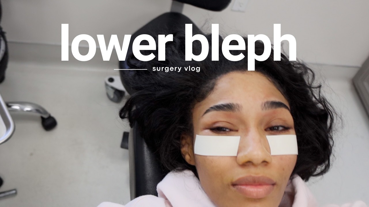 Lower Blepharoplasty Vlog | My Under Eye Bag Removal Surgery Experience Christian Chanel