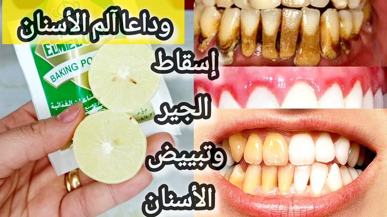 لن تحتاج للذهاب لطبيب الأسنان لتبييض الأسنان وإسقاط الجير سيسقط لوحده فقط بفرك أسنانك بهذا المكون ✅️