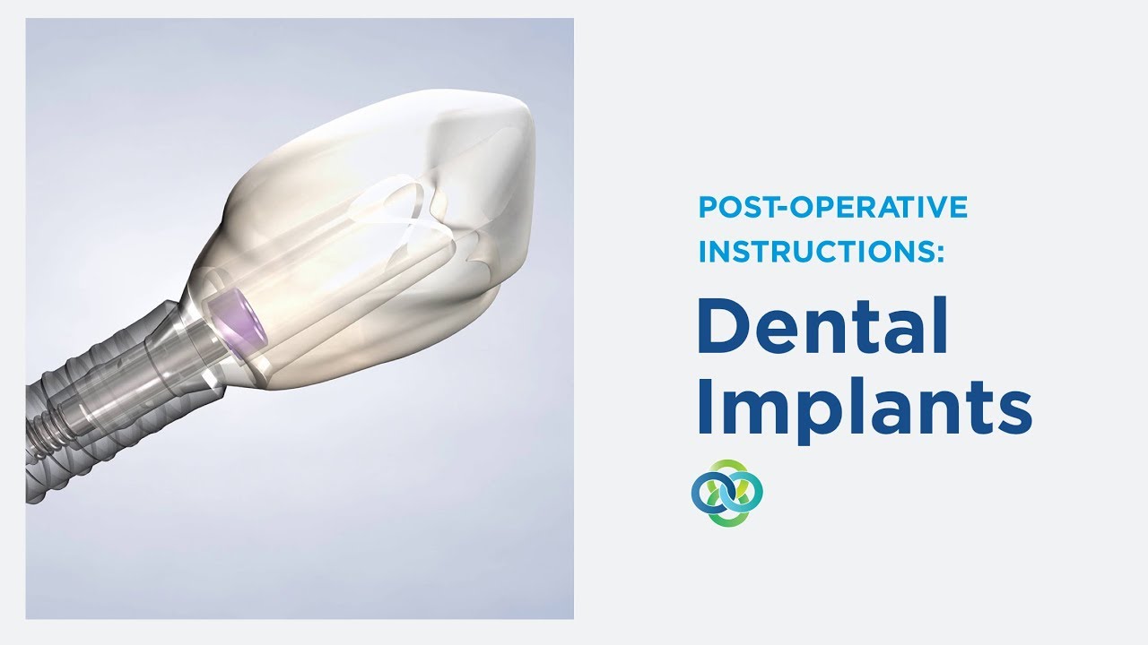 Post-Op Instructions: Dental Implants in Honolulu, HI, and Aiea, HI | Oral Surgery Hawaii