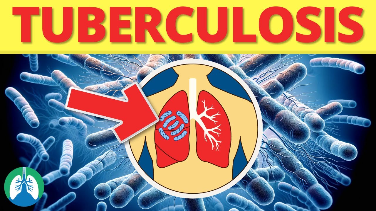 Tuberculosis (Medical Definition) | Quick Explainer Video