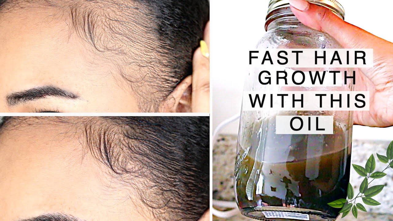 FAST! Natural Hair & Edge Growth in 1 Week!  With this Indian Hair Growth Oil (Alopecia Friendly)