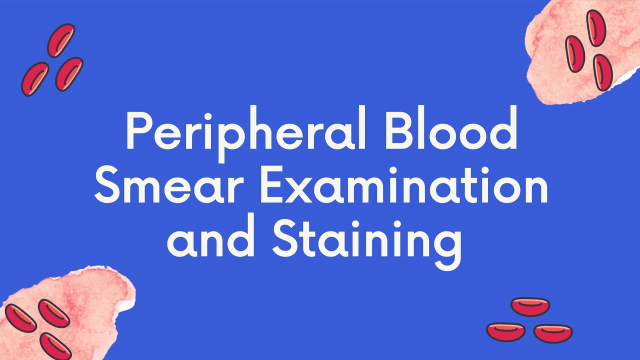 Staining and Examination of Peripheral Blood Smears