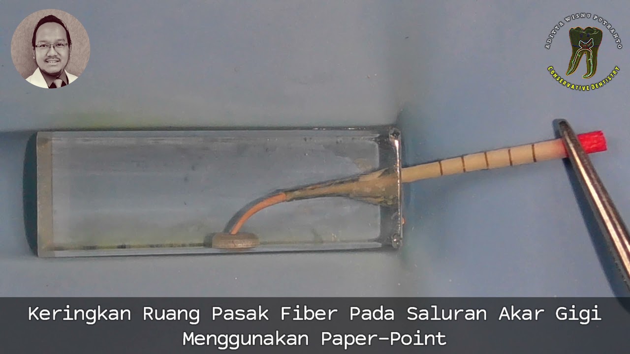Simulasi Preparasi & Sementasi Pasak Fiber