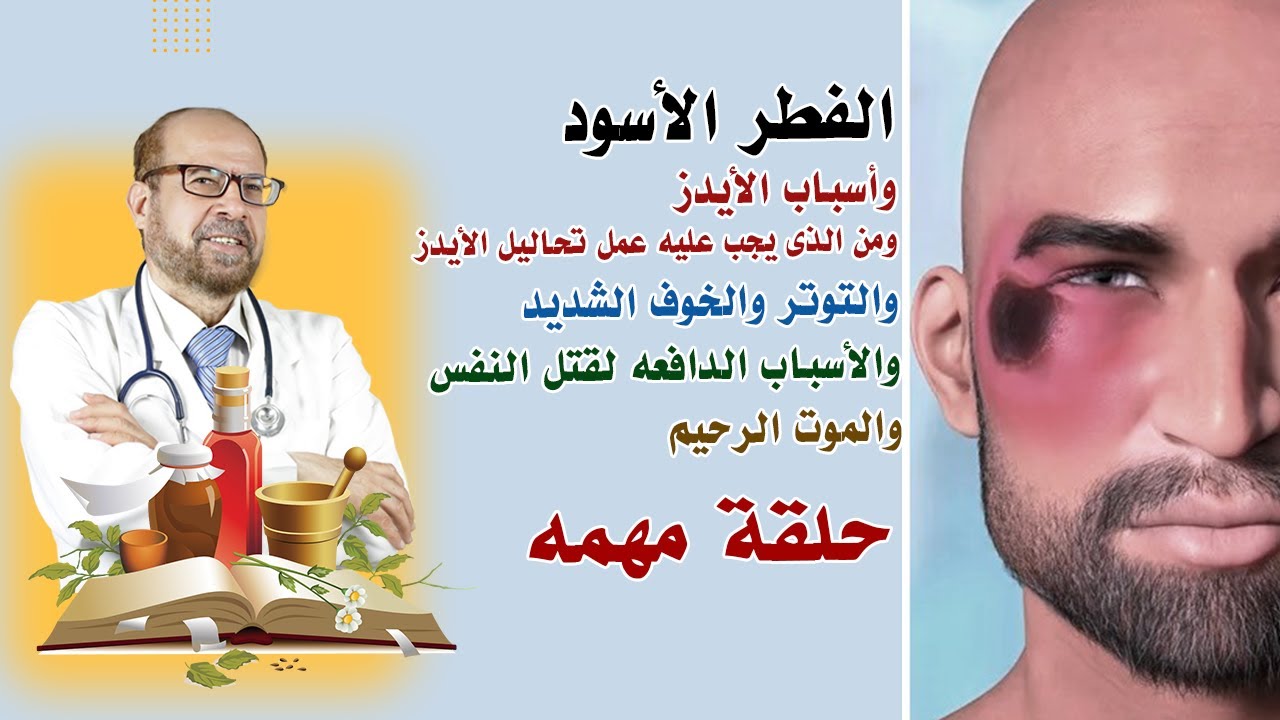 الفطر الأسود🍀 وأسباب الأيدز🍀 ومن الذى يجب عليه عمل تحاليل الأيدز🍀 والأسباب الدافعه لقتل النفس