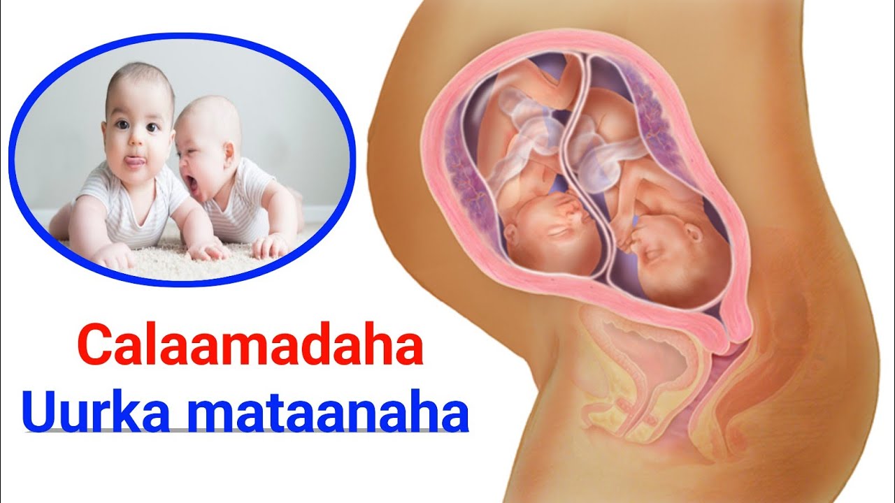 Uurka mataanaha 8- calaamad oo lagu garto Dr Zamzam #uurka_cusub