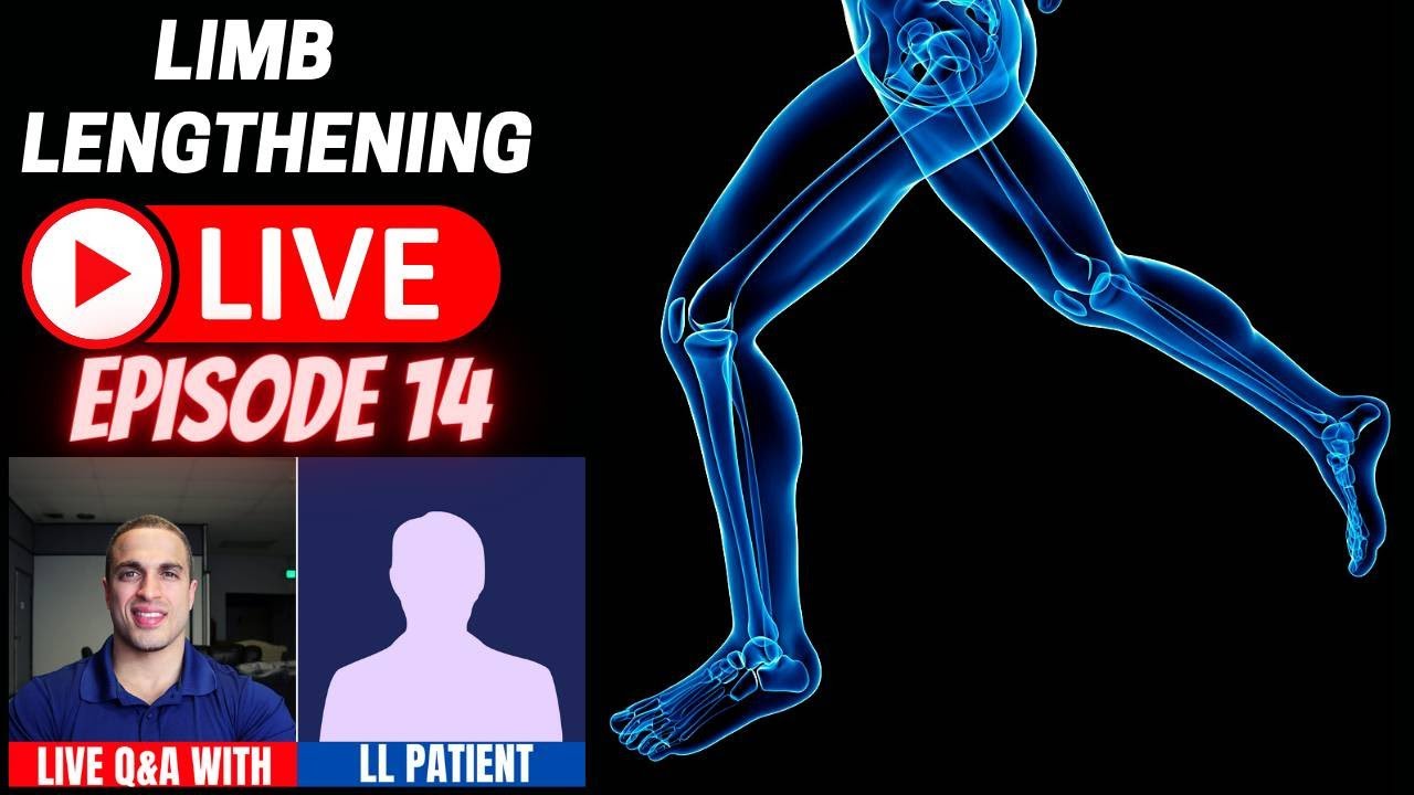 Limb Lengthening LIVE - Episode 14 - LIVE Q&A w/ Daniel - Cosmetic LON Femur Patient