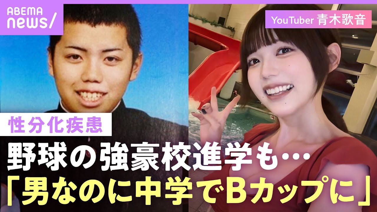 【性分化疾患】「トランスジェンダーとは違う」当事者・青木歌音の苦悩…体も