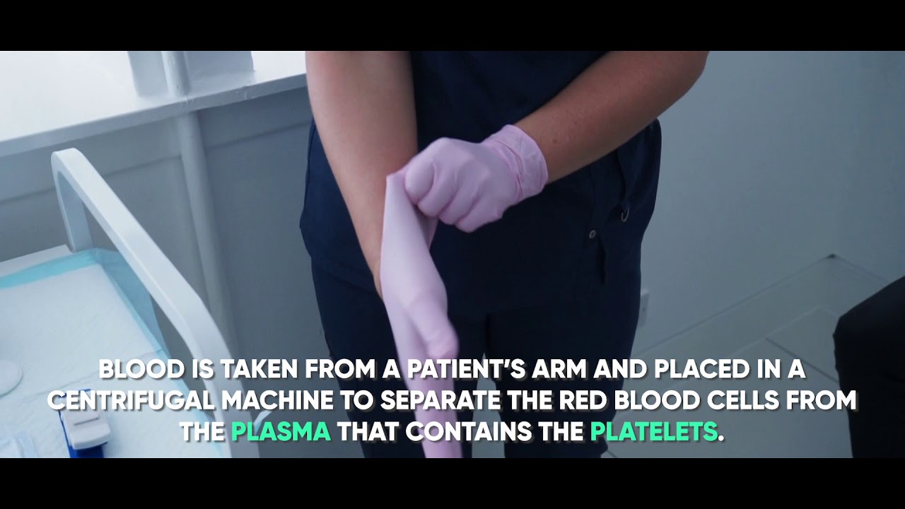 Vinci Hair Clinic PRP Platelet-Rich Plasma Hair Loss Treatment