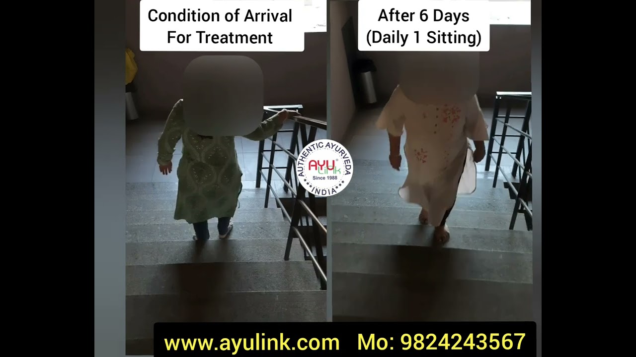 Arthrothermia - Pain Management 148 