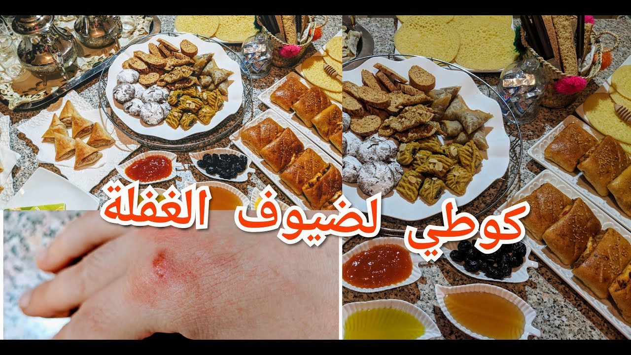من بعد هدالفيديو متهزي هم لضيوف الغفلة/يدي محروقة وحضرت مائدة بسرعة وحمرت وجهي