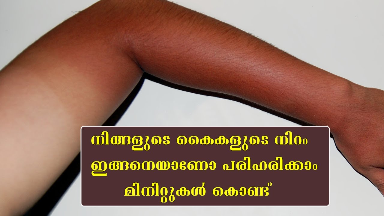 നിങ്ങളുടെ കൈകള്‍ ഇങ്ങനെയാണോ വിഷമിക്കേണ്ട വെളുപ്പിക്കാം   /Instant sun tan removal