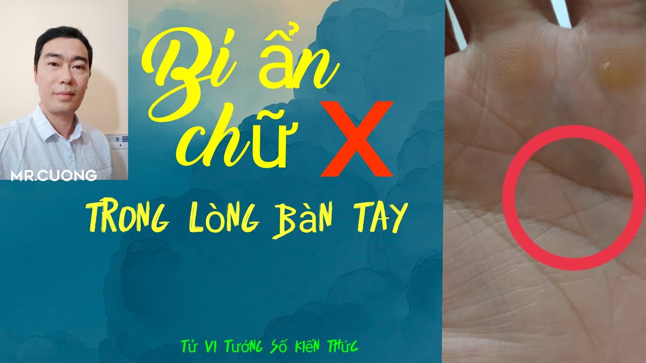 Giải Mã Dấu X Trong Lòng Bàn Tay Bạn