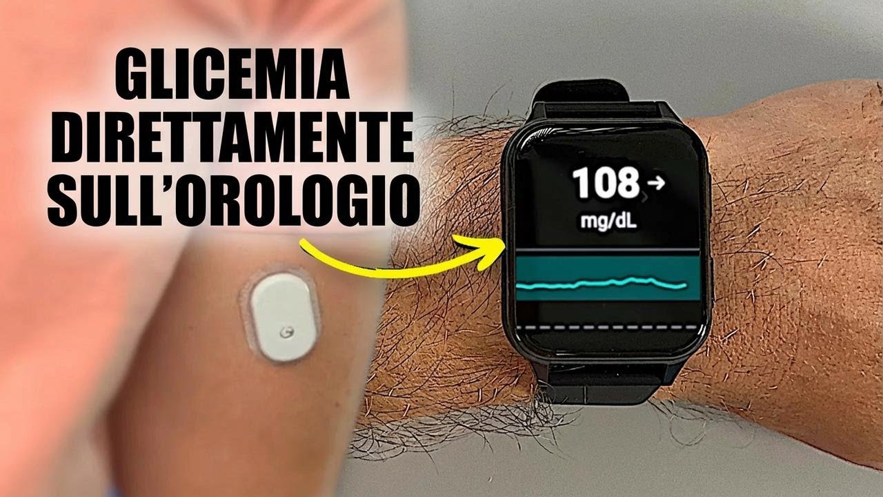 Ho provato un nuovo orologio CGM che funziona davvero!