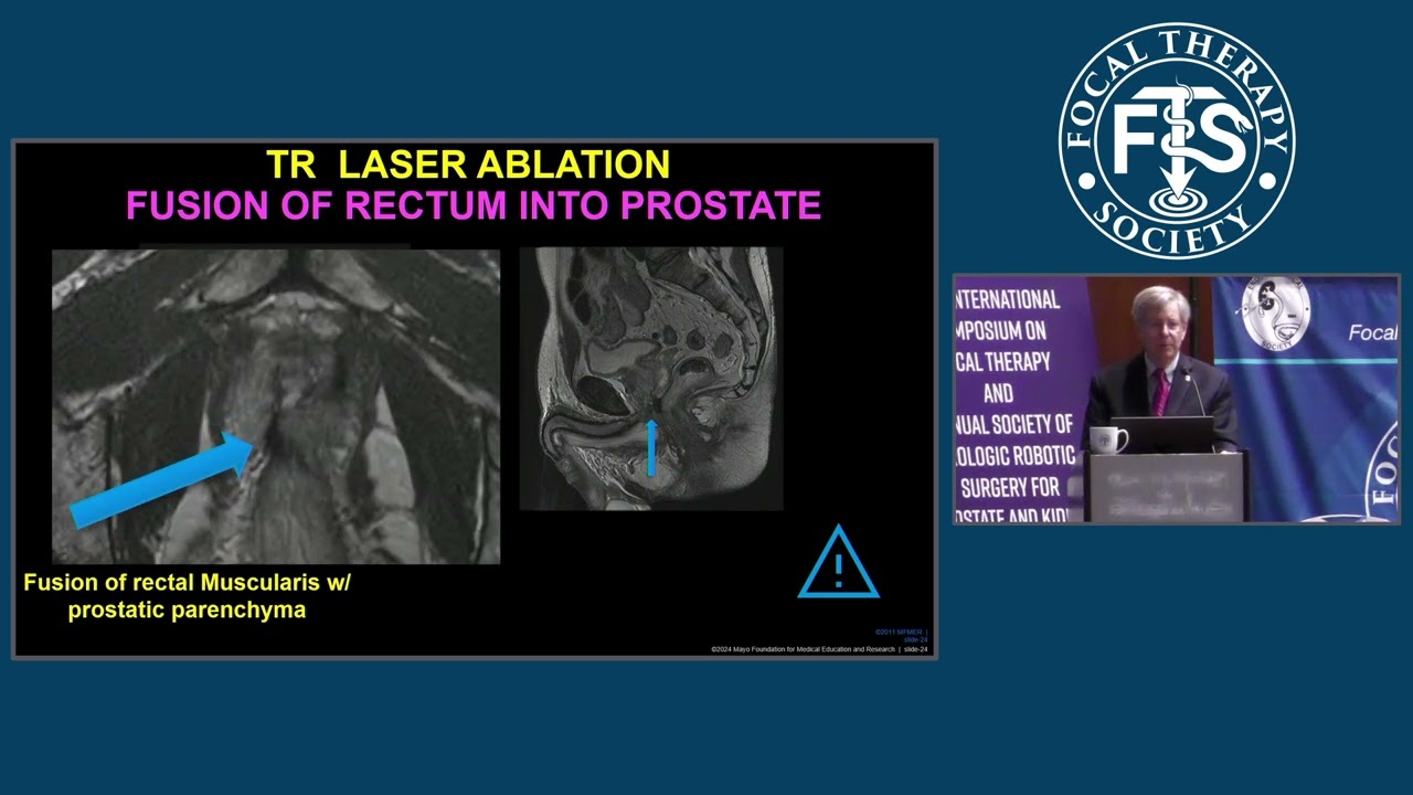 FTS 15 - Day 3 - Complications in Focal Therapy