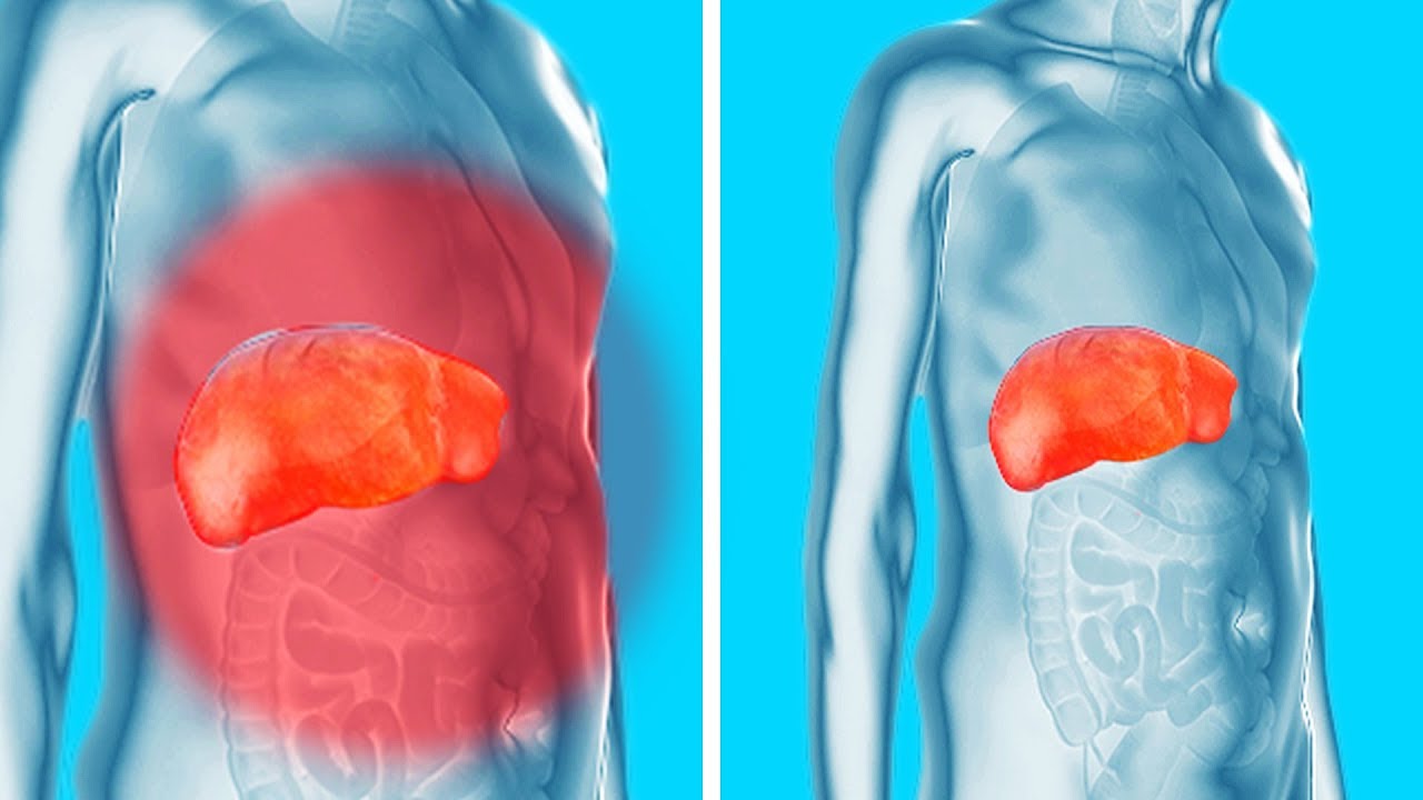 Débarrasse-toi Des Toxines Dans Tes Reins, Ton Foie et ta Vessie Doucement et Efficacement