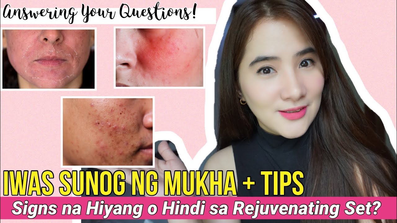 IWAS SUNOG TIPS + SIGNS NA HINDI KA HIYANG sa REJUVENATING SET | IWAS SUNOG NG MUKHA