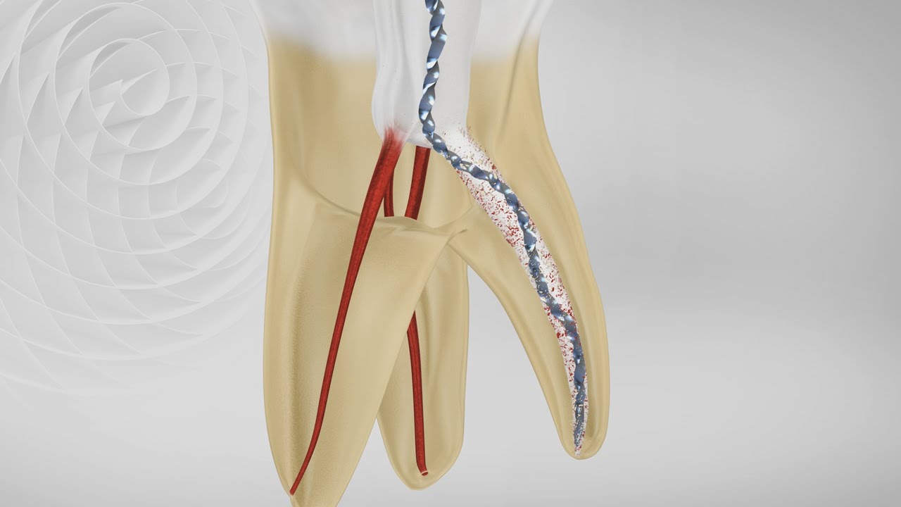 FKG XP-endo Shaper - English