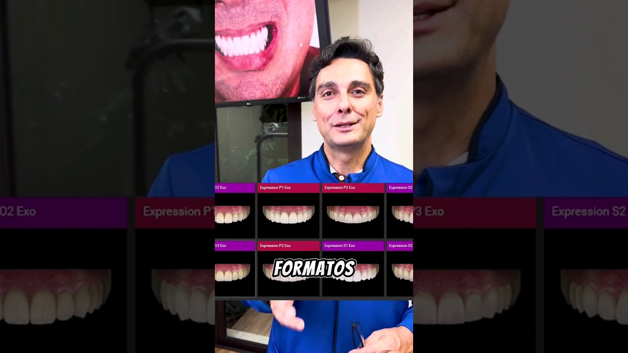 o Segredo do Formato dos Dentes #implantesdentarios