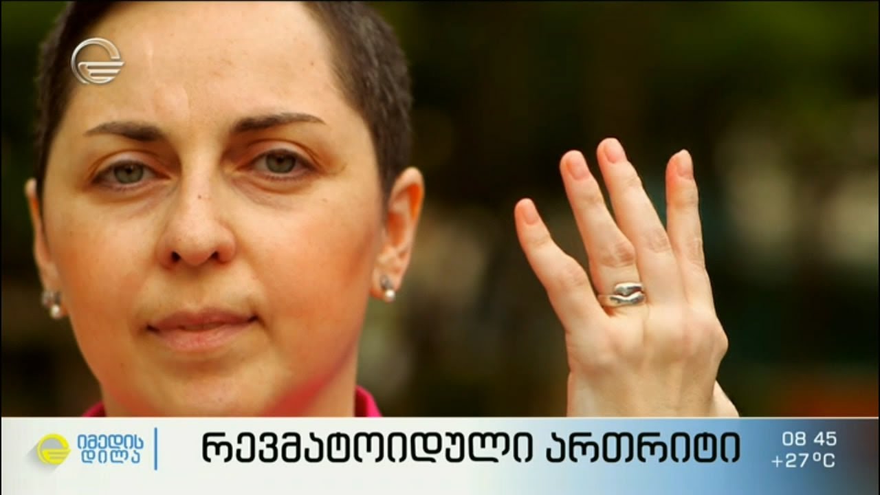 რევმატოიდული ართრიტი - ცხოვრება დიაგნოზით
