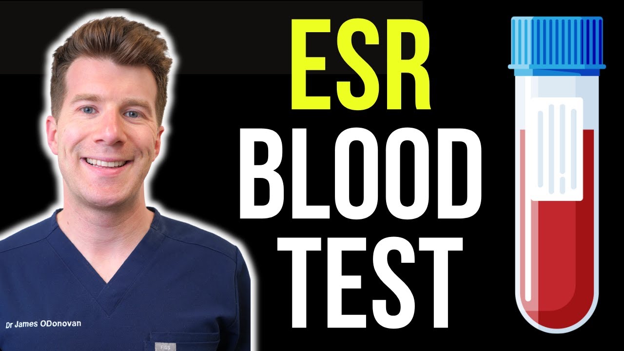 Doctor explains Erythrocyte Sedimentation Rate (ESR) blood test