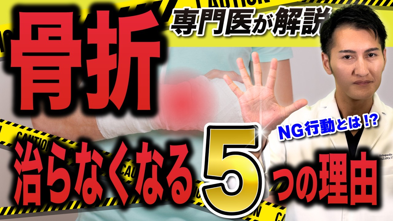 【注意！その行動が骨折 を悪化させる!】骨折が治らなくなる 5つの理由を整形外科医 が徹底解説！骨折を早く治す には