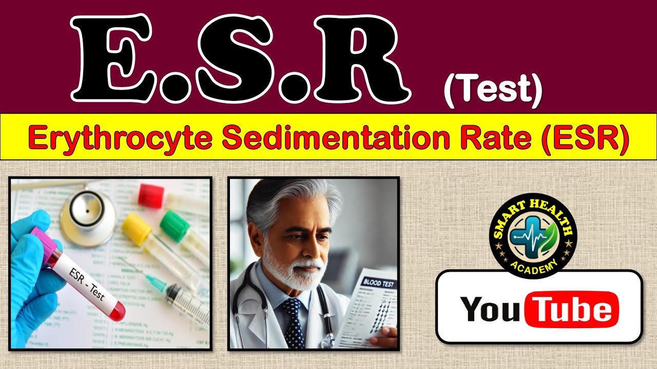 ESR test in hindi | Erythrocyte Sedimentation Rate (ESR) | Normal range | Smart Health Academy