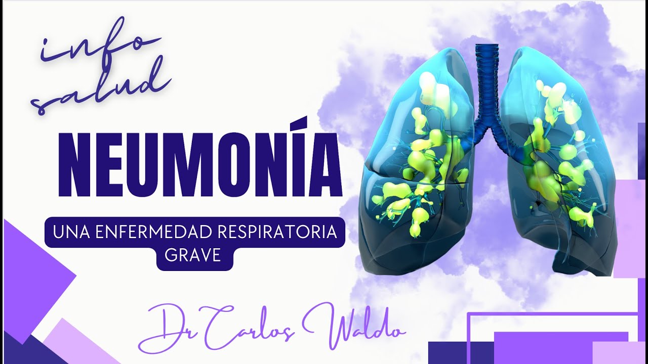 NEUMONÍA  UNA ENFERMEDAD RESPIRATORIA DELICADA