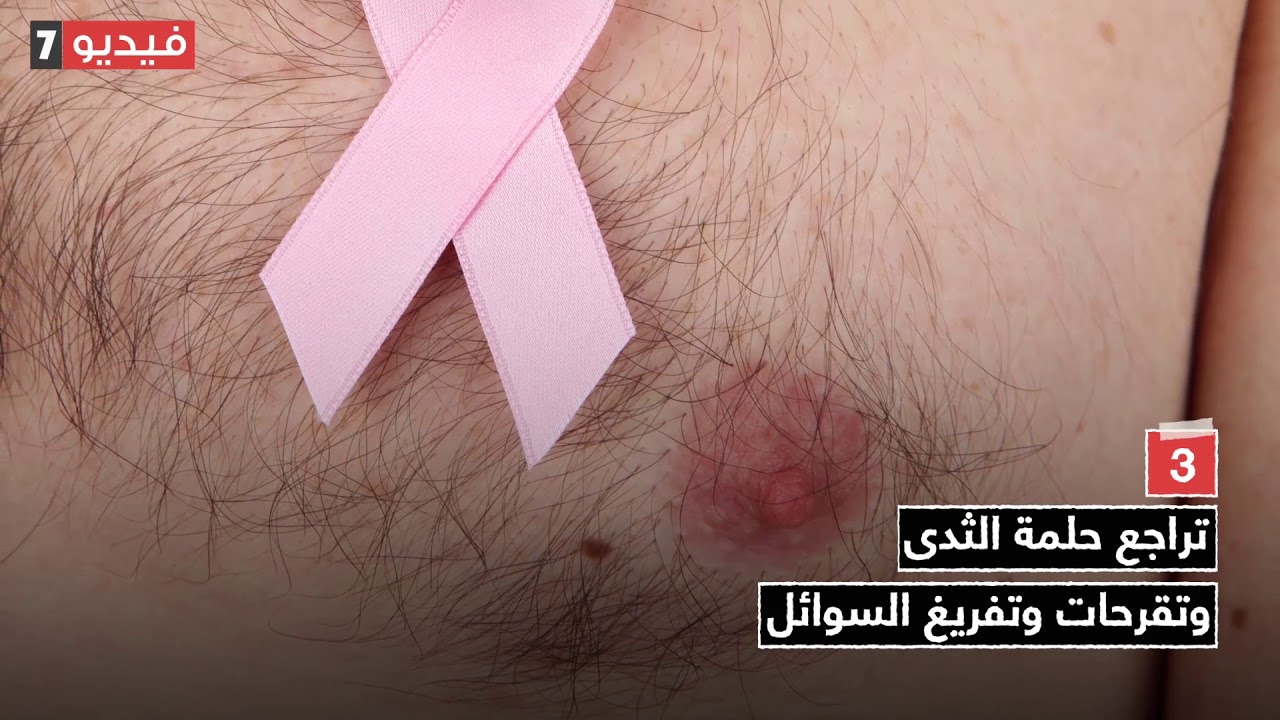 فيديو معلوماتى.. أعراض سرطان الثدى عند الرجال
