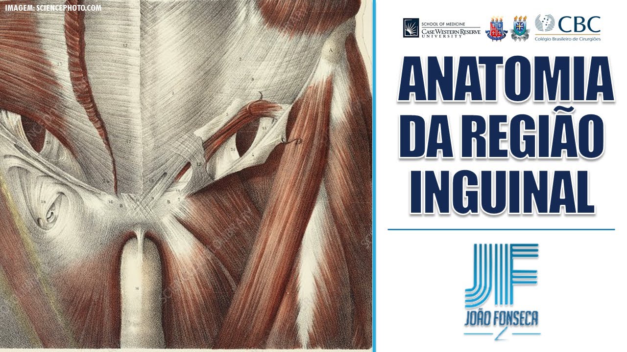 HÉRNIAS ABDOMINAIS (Parte 2): Canal e Região Inguinal (Anatomia) 👨🏽‍⚕️🚑 Joao Fonseca (Cir. Geral)