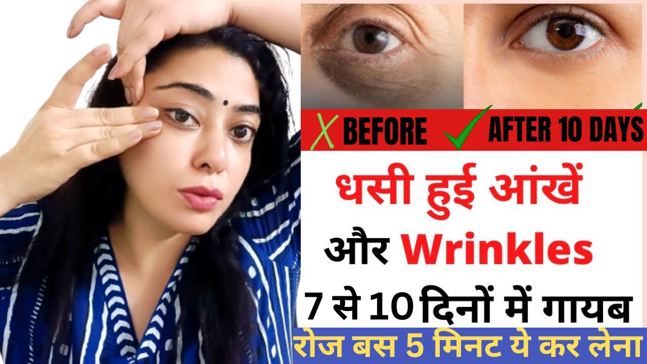 धसी हुई आंखें , Dark Circle और Wrinkles को 3 से7 दिनों में गायब करने का रामबाण घरेलू उपाय#Darkcircle