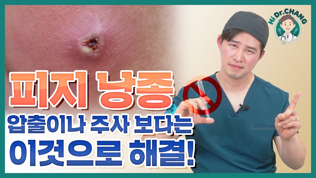 피지낭종! 압출, 주사 말고 이것으로 해결하세요