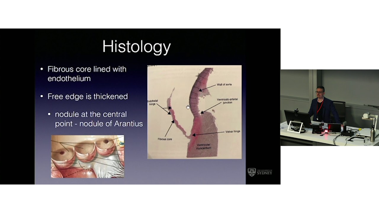 Surgical Anatomy of the Aortic Valve & Aortic Root - Dr Levi Bassin