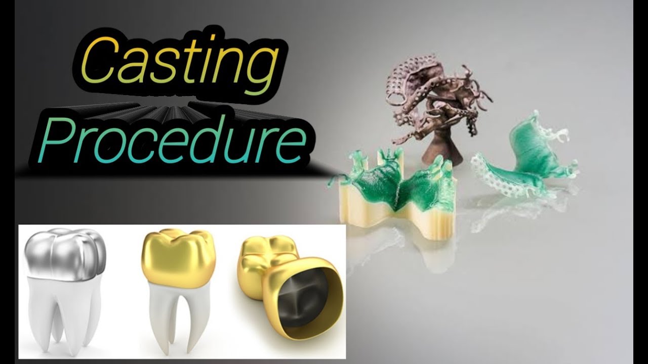 Casting Procedure in Dentistry