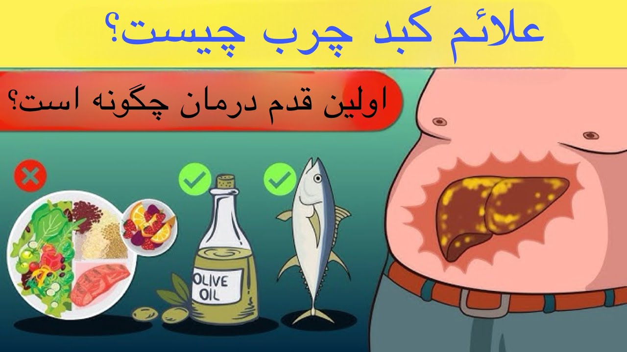 تشخیص کبد چرب چگونه است؟درمان کبد جرب در مراحل ابتدایی!