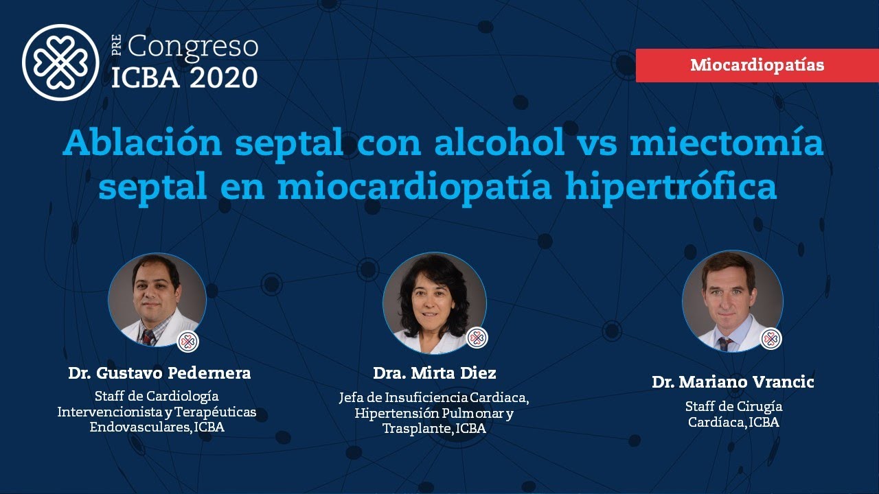 64 -  Ablación septal con alcohol vs miectomía septal en miocardiopatía hipertrófica