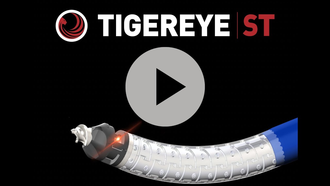 Tigereye ST Explainer Video